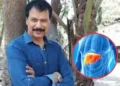 CID फेम Dinesh Fadnis की लिवर डैमेज से मौत, बीमारी के लक्षण और बचाव