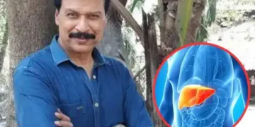 CID फेम Dinesh Fadnis की लिवर डैमेज से मौत, बीमारी के लक्षण और बचाव